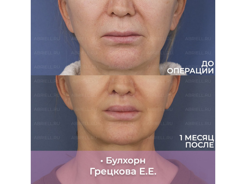 Часто по фото кажется, что после булхорна верхняя ...